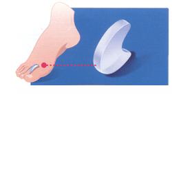 PODOGEL DIVARICATORE MISURA SMALL - Farmapanda Srl