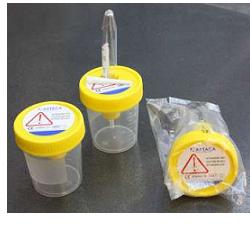 CONTENITORE PER URINA DA 120ML TAPPO A VITE CON DISPOSITIVO DI PRELIEVO DA PROVETTA SOTTOVUOTO IN POLIPROPILE - Farmapanda Srl